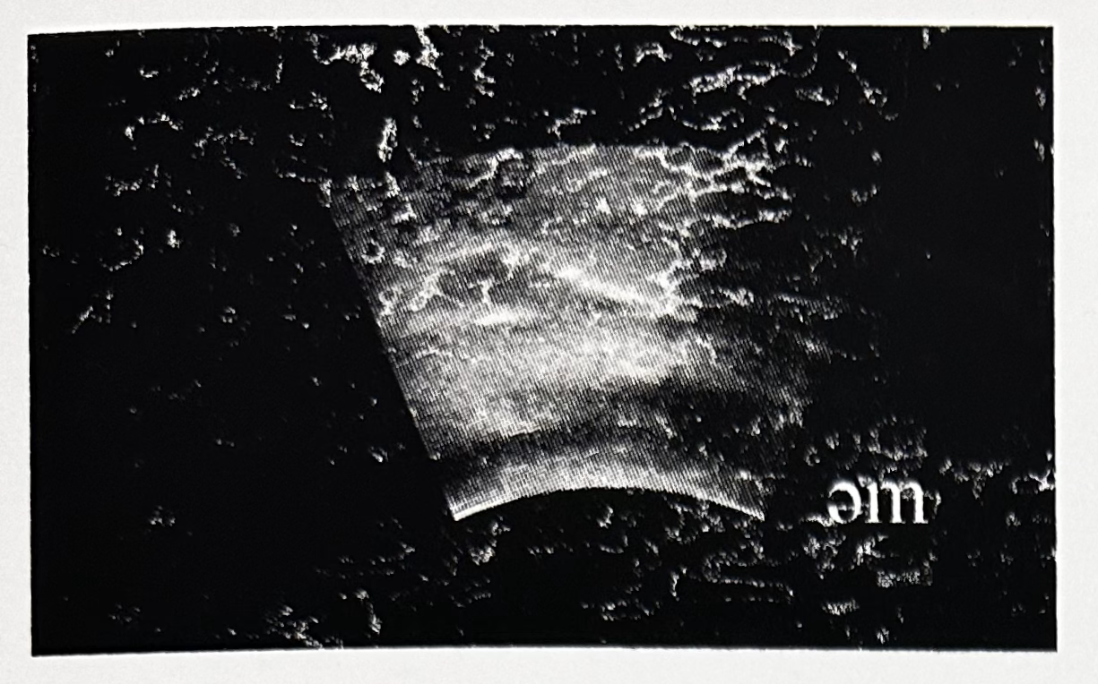 Thumbnail photo: Ultrasonic Tongue Imaging